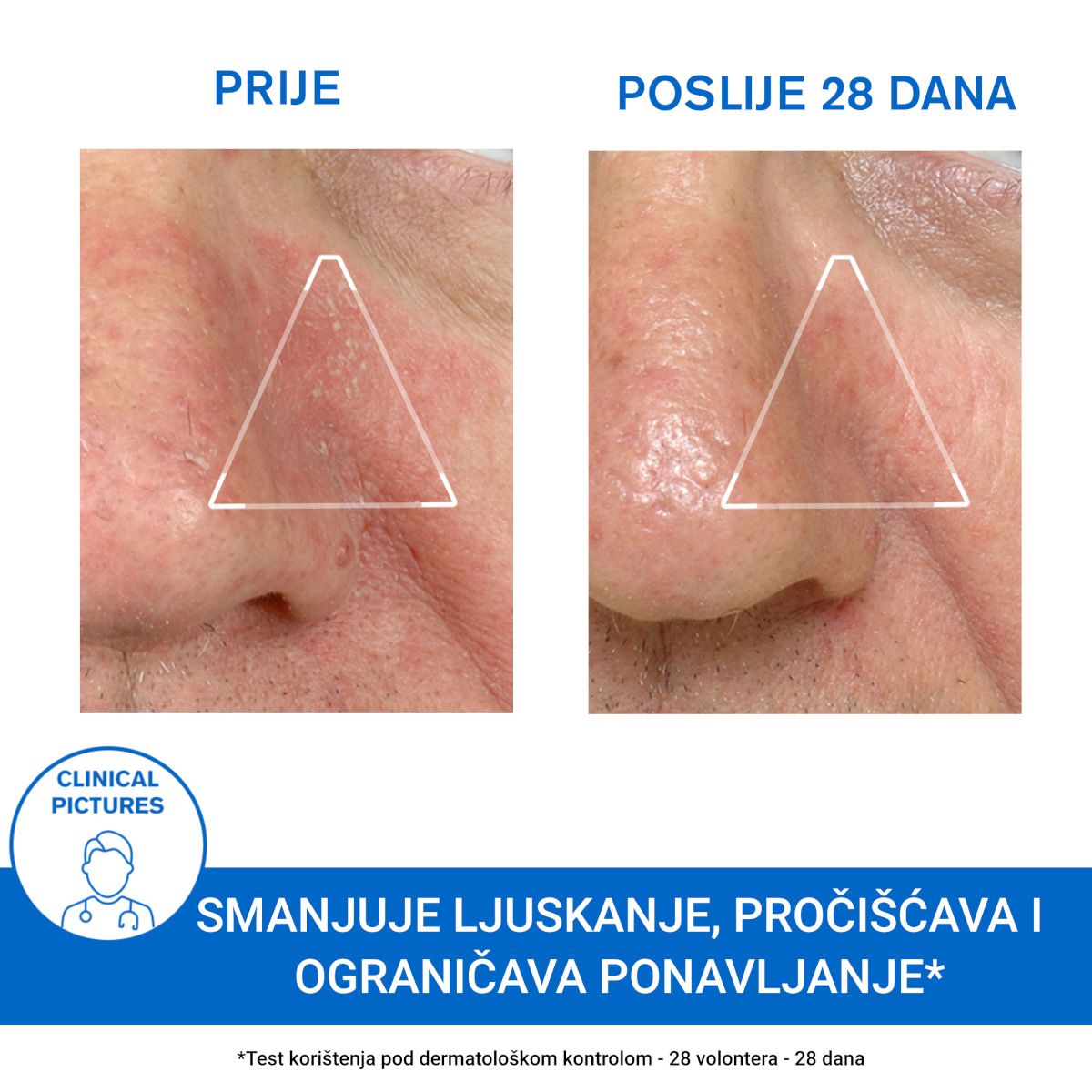URIAGE D.S hidratantna emulzija
