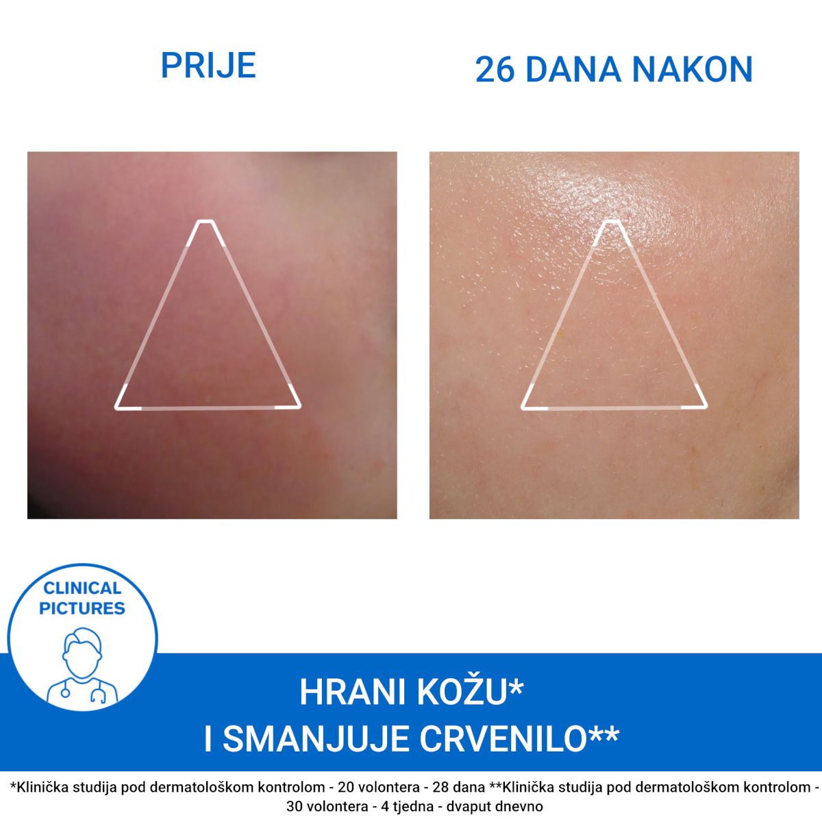 Slika proizvoda URIAGE Xemose krema za lice iz online apoteke Moja Farmacija - BIH